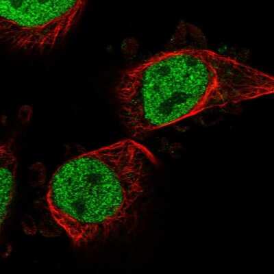 Immunocytochemistry/ Immunofluorescence: PTRHD1 Antibody [NBP1-93543]