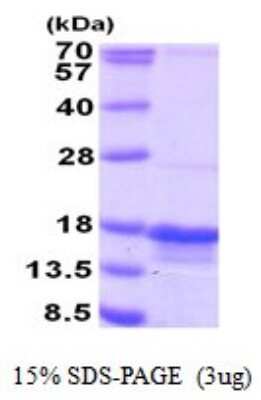SDS-PAGE: Recombinant Human PTRHD1 His Protein [NBP2-51830]
