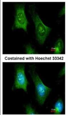 Immunocytochemistry/ Immunofluorescence: PTS Antibody [NBP1-32975]