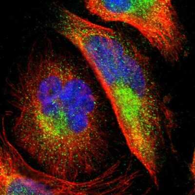 Immunocytochemistry/ Immunofluorescence: PTS Antibody [NBP1-87187]