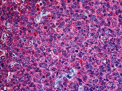 Immunohistochemistry-Paraffin: PTTG1 Antibody [NBP2-69985]