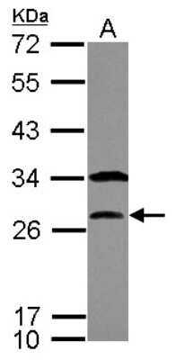 Western Blot: PTTG1 Antibody [NBP2-20287]