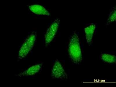 Immunocytochemistry/ Immunofluorescence: PTTG1IP Antibody (4C11) [H00000754-M04]