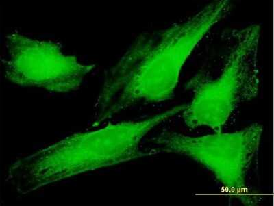 Immunocytochemistry/ Immunofluorescence: PTTG1IP Antibody [H00000754-B01P]