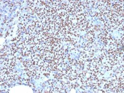 Immunohistochemistry-Paraffin: PU.1/Spi-1 Antibody (PU1/2146) - Azide and BSA Free [NBP2-75766]