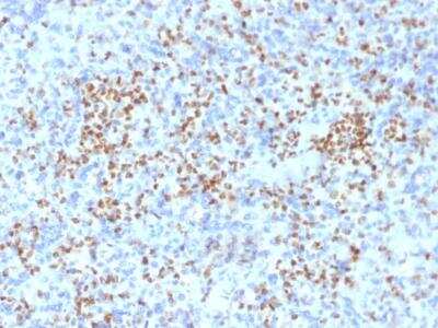 Immunohistochemistry-Paraffin: PU.1/Spi-1 Antibody (PU1/2146) [NBP2-75738]