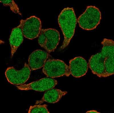 Immunocytochemistry/ Immunofluorescence: PU.1/Spi-1 Antibody [NBP2-33427]
