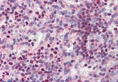 Immunohistochemistry-Paraffin: PU.1/Spi-1 Antibody [NBP1-00135]