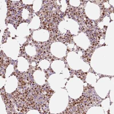 Immunohistochemistry-Paraffin: PU.1/Spi-1 Antibody [NBP2-33427]