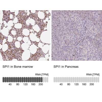 Immunohistochemistry-Paraffin: PU.1/Spi-1 Antibody [NBP2-33427]