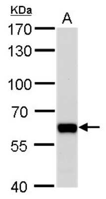 Western Blot: PUF60 Antibody (3510) [NBP2-43835]