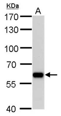 Western Blot: PUF60 Antibody (3510) [NBP2-43835]