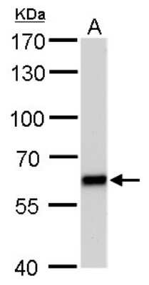 Western Blot: PUF60 Antibody (677) [NBP2-43836]