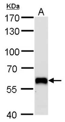 Western Blot: PUF60 Antibody (917) [NBP2-43764]