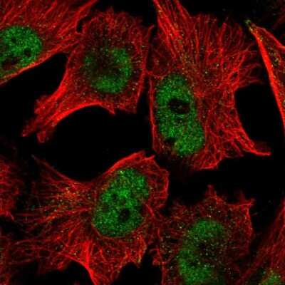 Immunocytochemistry/ Immunofluorescence: PUF60 Antibody [NBP2-49303]