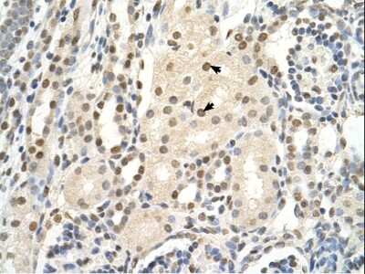 Immunohistochemistry: PUF60 Antibody [NBP1-57501]