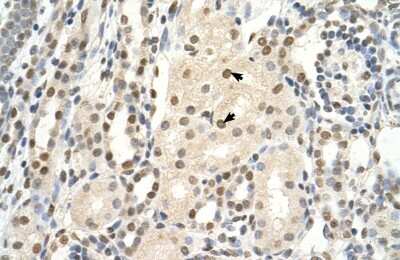 Immunohistochemistry-Paraffin: PUF60 Antibody [NBP1-57427]
