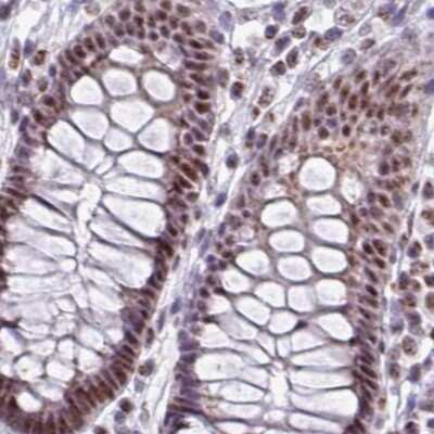 Immunohistochemistry-Paraffin: PUF60 Antibody [NBP2-49032]