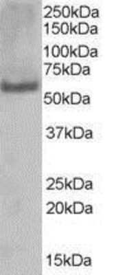 Western Blot: PUF60 Antibody [NB100-1125]