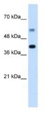 Western Blot: PUF60 Antibody [NBP1-57501]