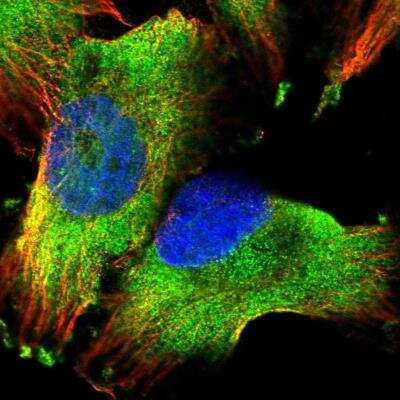 Immunocytochemistry/ Immunofluorescence: PUM1 Antibody [NBP1-87856]