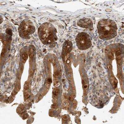 Immunohistochemistry-Paraffin: PUM1 Antibody [NBP1-87856]
