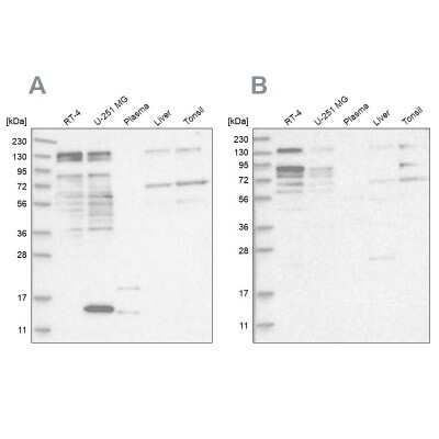 Western Blot: PUM1 Antibody [NBP1-87856]