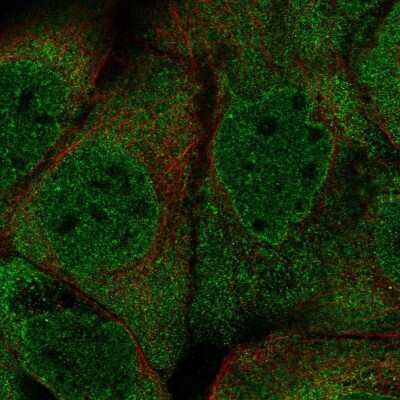 Immunocytochemistry/ Immunofluorescence: PUM2 Antibody [NBP2-56823]