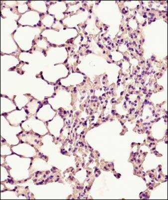Immunohistochemistry-Paraffin: PUMA Antibody [NB100-56370]