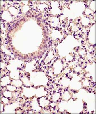 Immunohistochemistry-Paraffin: PUMA Antibody [NB100-56370]