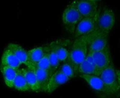 Immunocytochemistry/ Immunofluorescence: PUMA Antibody (SR42-09) [NBP2-67326]