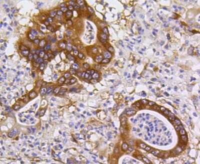 Immunohistochemistry-Paraffin: PUMA Antibody (SR42-09) [NBP2-67326]