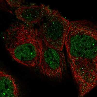 Immunocytochemistry/ Immunofluorescence: PURL Antibody [NBP1-84691]