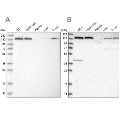 Western Blot: PURL Antibody [NBP1-84692]