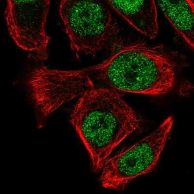 Immunocytochemistry/ Immunofluorescence: PUS3 Antibody [NBP2-55852]
