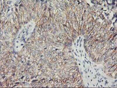 Immunohistochemistry-Paraffin: Nectin-1/PVRL1 Antibody (OTI6F8) [NBP2-01198]