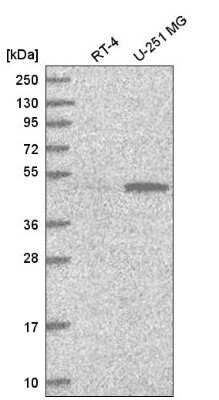 Western Blot: PWP1 Antibody [NBP2-58751]