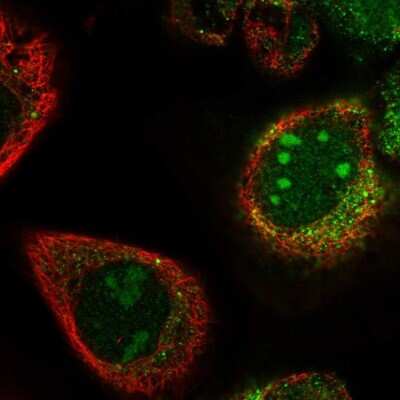 Immunocytochemistry/ Immunofluorescence: PWP2H Antibody [NBP1-84884]