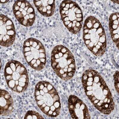 Immunohistochemistry-Paraffin: PWP2H Antibody [NBP1-84884]