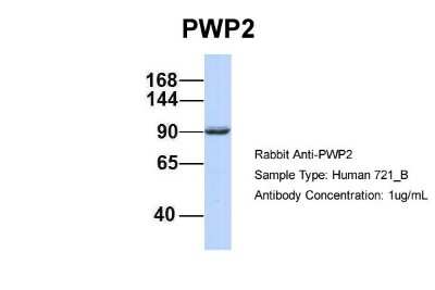 Western Blot: PWP2H Antibody [NBP1-52844]