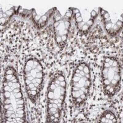 Immunohistochemistry-Paraffin: PWWP2B Antibody [NBP3-17422]