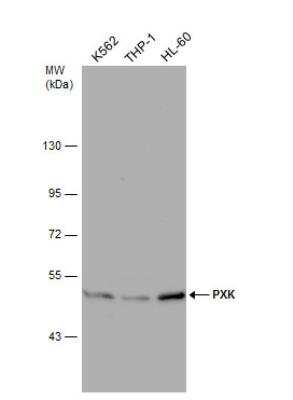 Western Blot: PXK Antibody [NBP1-33230]