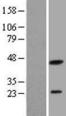 Western Blot: PXMP2 Overexpression Lysate [NBL1-15012]
