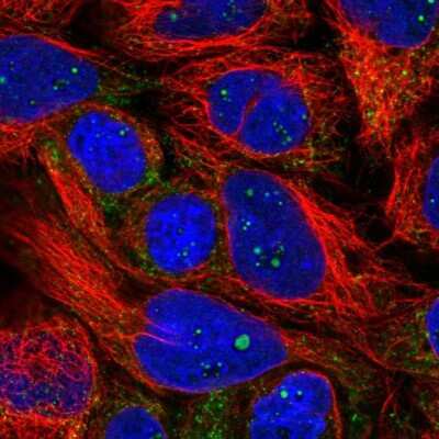 Immunocytochemistry/ Immunofluorescence: PXMP4 Antibody [NBP2-14703]