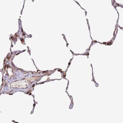 Immunohistochemistry-Paraffin: PXMP4 Antibody [NBP2-14703]