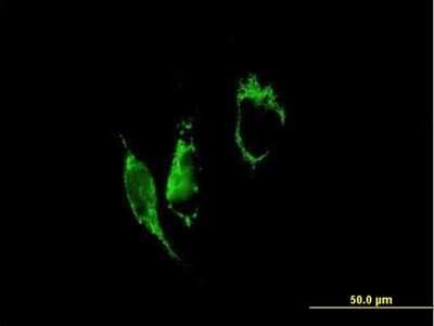 Immunocytochemistry/ Immunofluorescence: PYCR1 Antibody [H00005831-B01P]