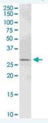 Western Blot: PYCR1 Antibody [H00005831-B01P]