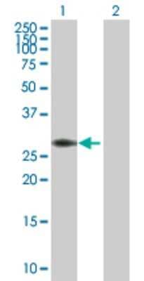 Western Blot: PYCR1 Antibody [H00005831-D01P]