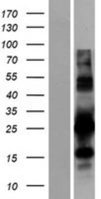 Western Blot: PYCR1 Overexpression Lysate [NBP2-07559]