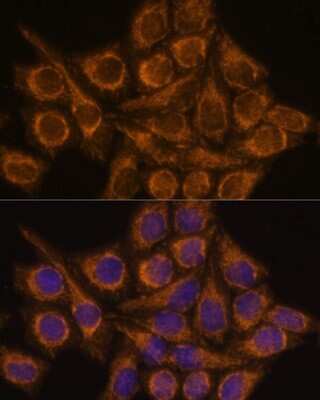 Immunocytochemistry/ Immunofluorescence: PYCR2 Antibody - Azide and BSA Free [NBP2-93882]